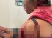 Di Pringsewu Seorang Ibu Nyaris Tewas Ditangan Anak Kandung