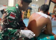 Satgas Yonarmed 11 Kostrad Selamatkan Korban Luka Bakar di Sebatik Tengah