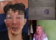 12 Terduga Pelaku Penganiayaan masih Bebas Berkeliaran, Pihak Pelapor Menyangkan lamban nya kinerja kepolisian Polsek Medang Deras.