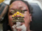 Sudah Seminggu Pasca Tewasnya Wartawan Nico di Medan, Masih Menjadi Misteri!!