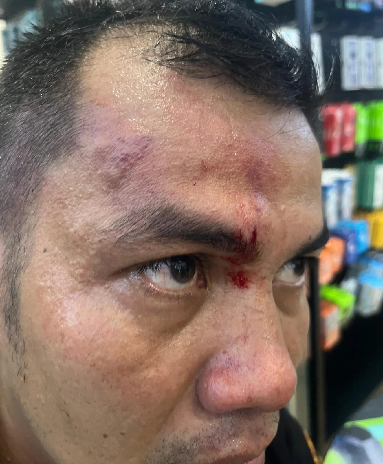 Puluhan Debt Collector ACC Finance Rantauprapat Mengeroyok Insan Pers IMG-20250920-WA0171(1)