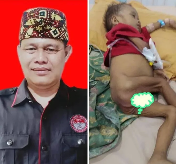 Kasus Stunting di Pesawaran: Balita 2,6 Tahun Dirawat di RS Abdul Moeloek, Pengawasan Program Dipertanyakan Screenshot_20250915-081937_1